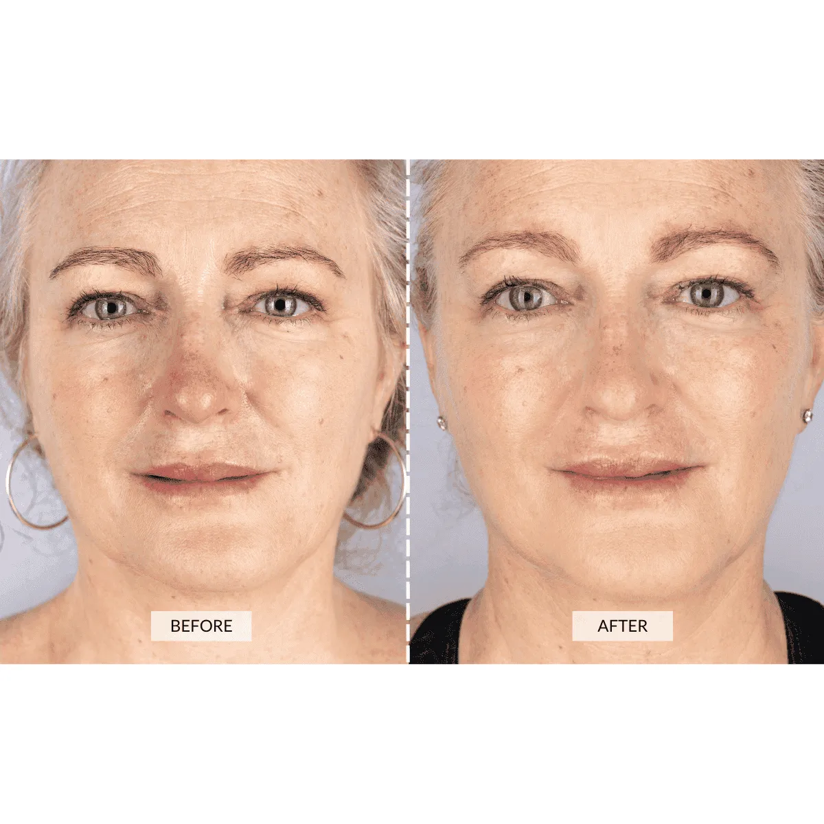Offer - CurrentBody Skin Light Therapy Face Mask